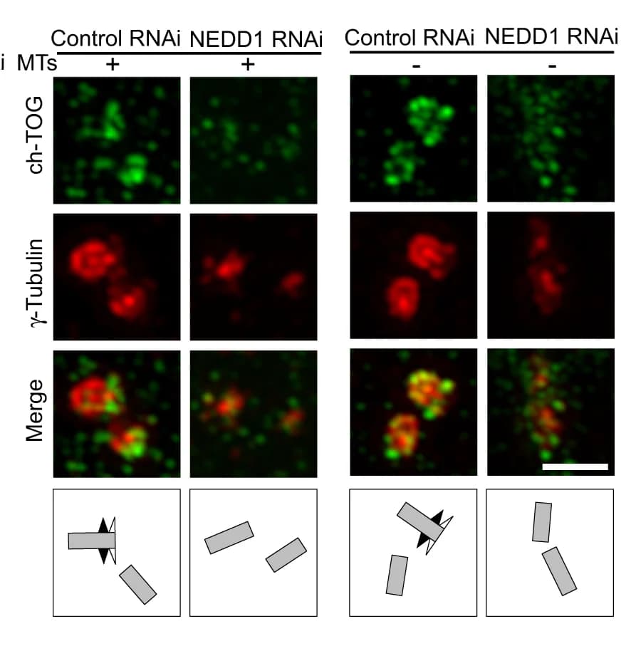 Open access visualization of Microscopy, Illustration, U2OS Cells, NEDD1 siRNA, Microtubules