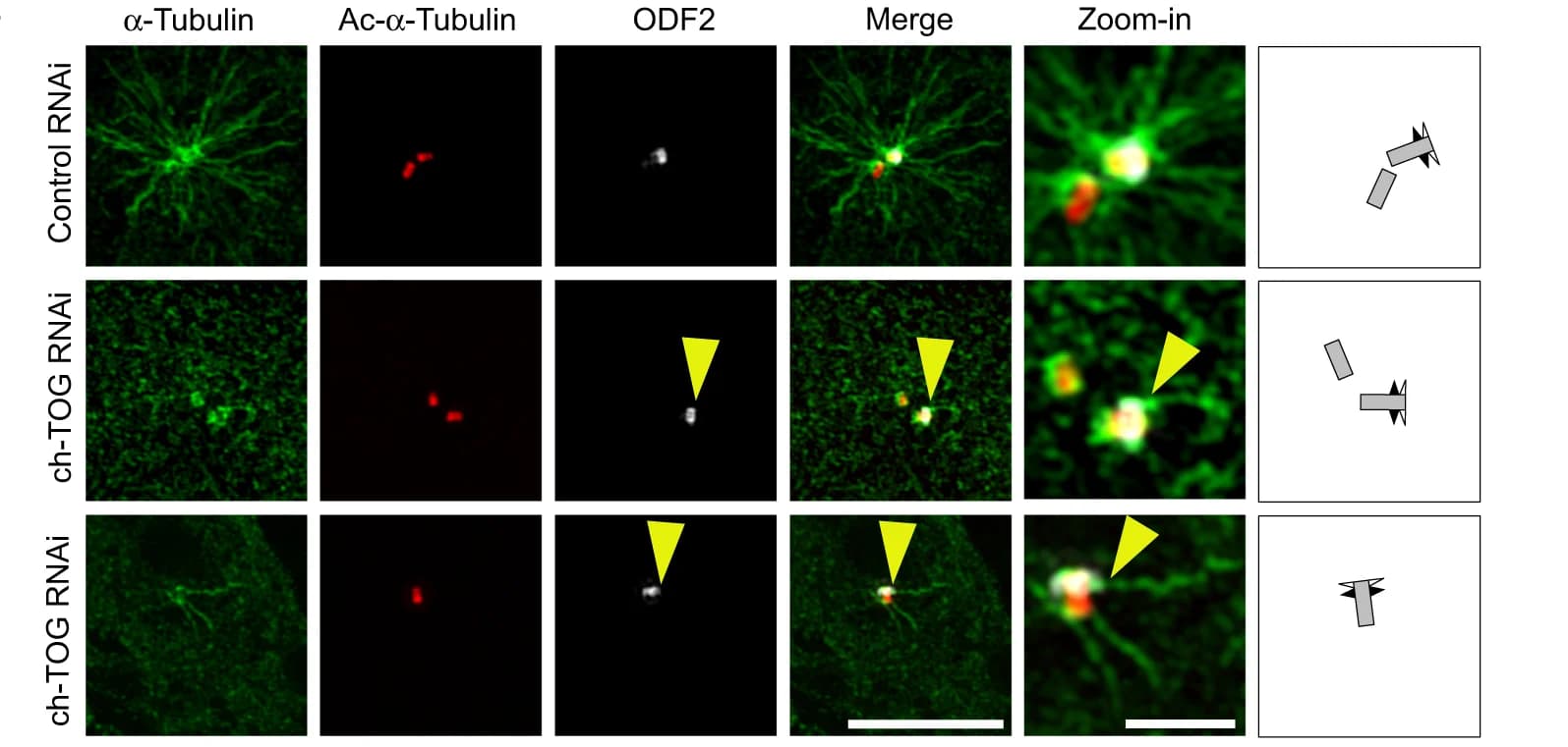 Open access visualization of Microscopy, Illustration, U2OS Cells, siRNA, Microtubules