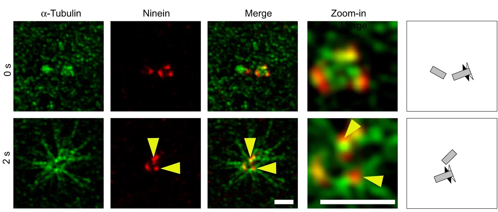 Open access visualization of Microscopy, Illustration, Microtubules, Cold Treatment, Centrioles