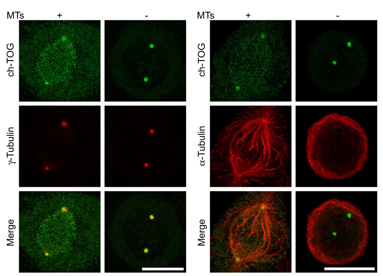 Open access visualization of Microscopy, ch-TOG, Mitotic Centrosomes, Microtubules, gamma-tubulin