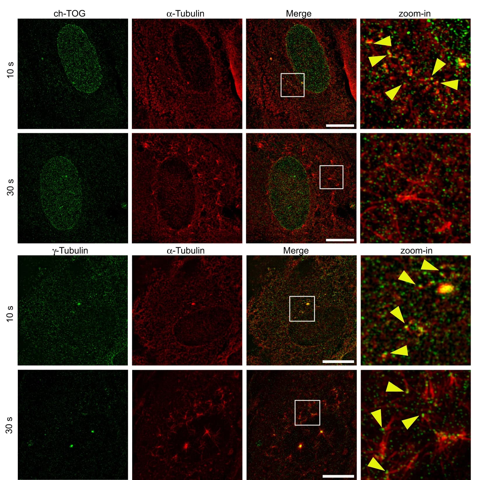 Open access visualization of Microscopy, RPE1 Cells, Microtubule Depolymerization, Nocodazole, Cold Treatment
