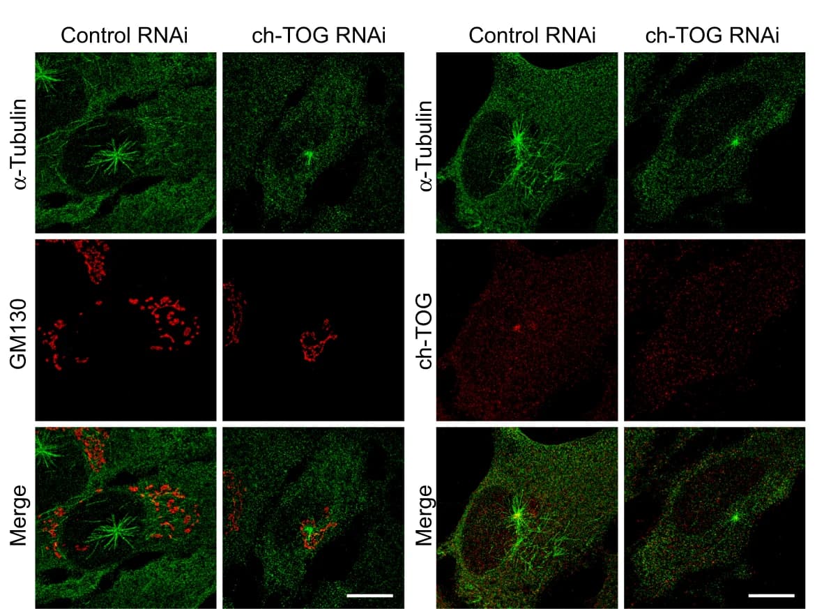 Open access visualization of Microscopy, RPE1 Cells, ch-TOG RNAi Cells, Nocodazole, Microtubules