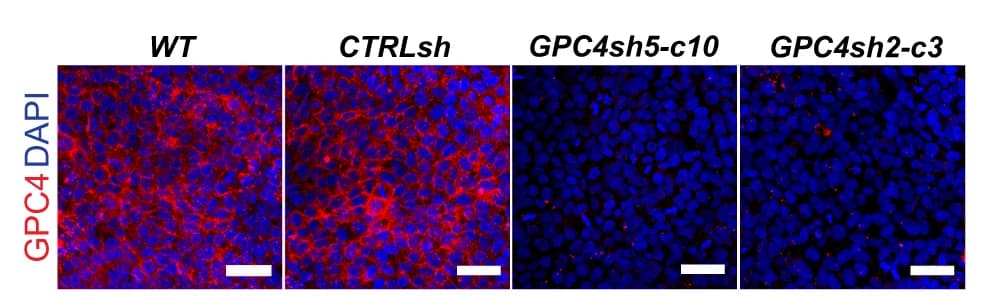 Open access visualization of Microscopy, RNA-seq, Transcript Levels, Epithelial Genes, Mesenchymal Genes