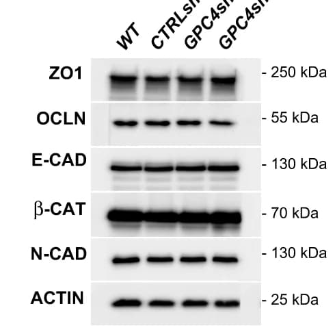 Open access visualization of Gel, Western Blot, ZO1, OCLN, E-CAD