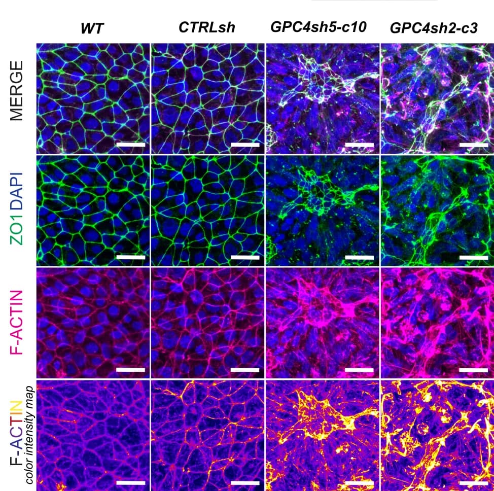 Open access visualization of Microscopy, Immunofluorescence, ZO1, F-ACTIN, hiPSCs