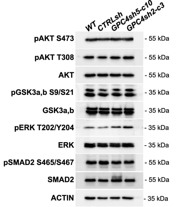 Open access visualization of Gel, Western-blot, Protein extract, hiPSCs, AKT