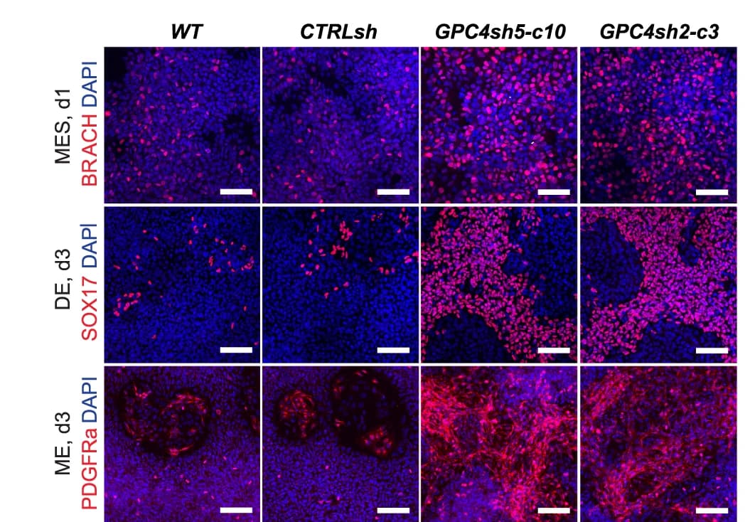 Open access visualization of Microscopy, Immunofluorescence, BRACH, SOX17, PDGFRa