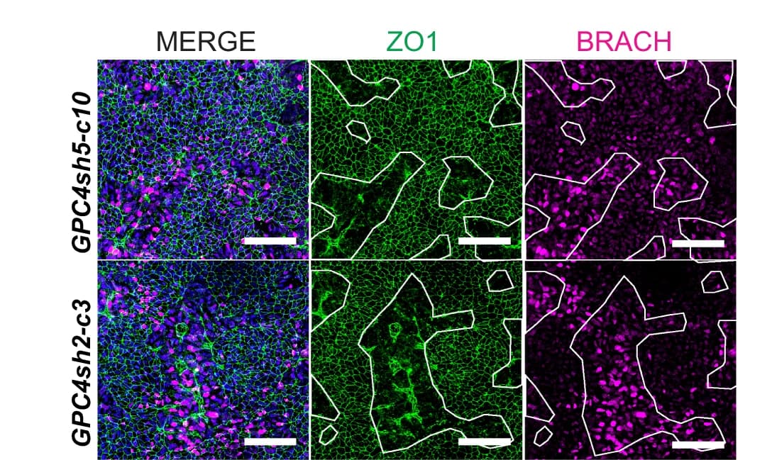 Open access visualization of Microscopy, GPC4sh5-c10 hiPSCs, GPC4sh2-c3 029 hiPSCs, MES differentiation, ACTIVIN A