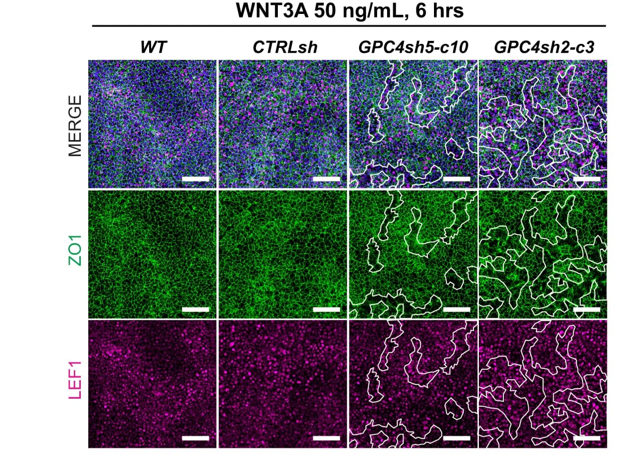 Open access visualization of Microscopy, WT, CTRLsh, GPC4sh5-c10, GPC4sh2-c3 029 hiPSCs