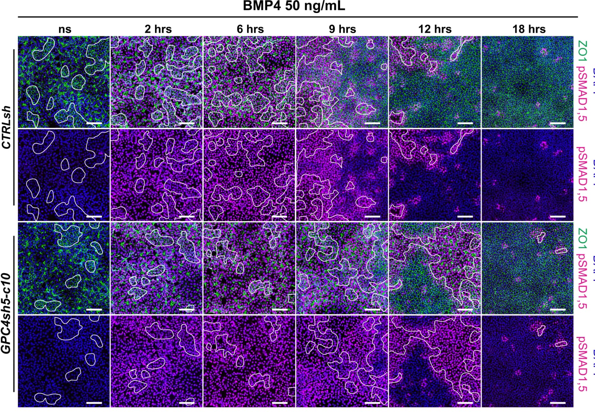 Open access visualization of Microscopy, TJ formation, CTRLsh hiPSCs, GPC4sh hiPSCs, Cell dissociation