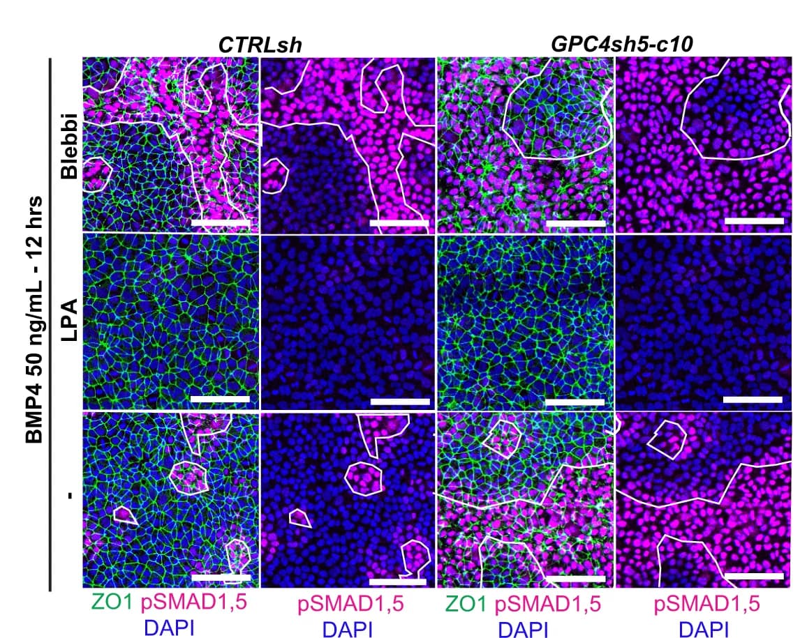 Open access visualization of Microscopy, pSMAD1,5, ZO1, Control Cells, shGPC4 Cells