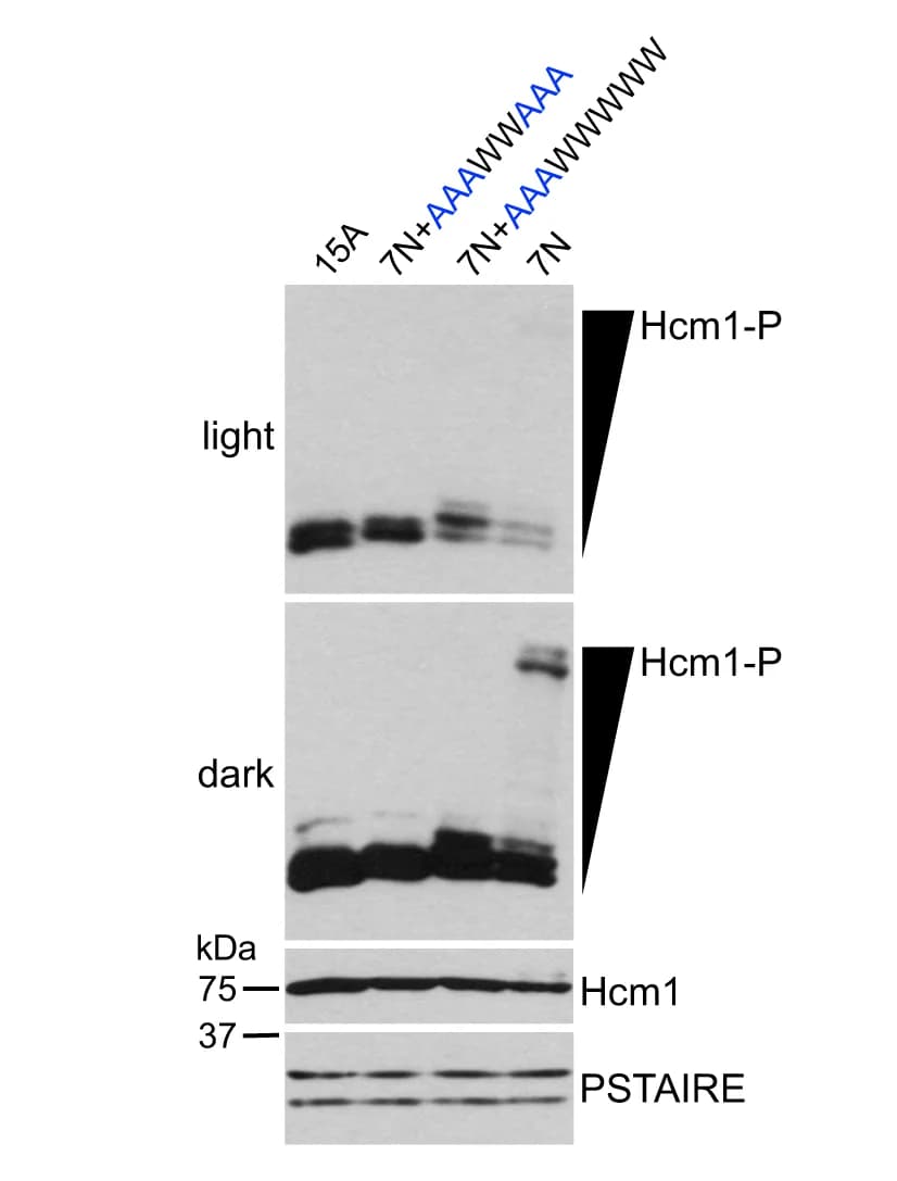 Open access visualization of Gel, Phos-Tag Western Blots, Hcm1 Mutants, A-P Mutations, S/T-P Sites
