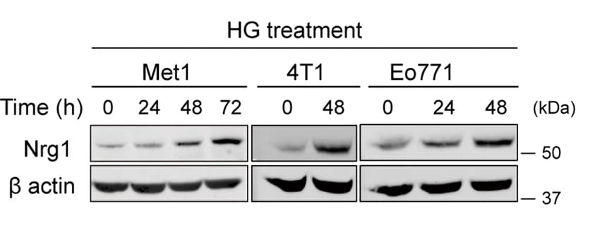 Open access visualization of Gel, Western Blot, Nrg1, Beta Actin, Protein Levels
