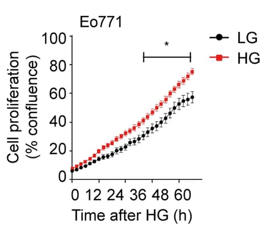 Open access visualization of Line Plot, Error Bars, Proliferation Analysis, Breast Cancer Cells, Low Glucose