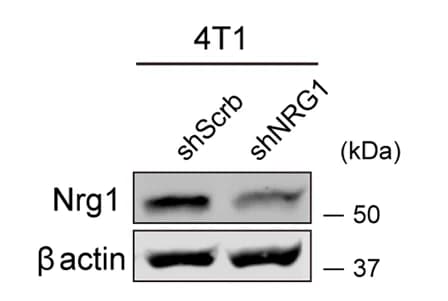 Open access visualization of Gel, Western Blot, NRG1, shScrb, shNRG1