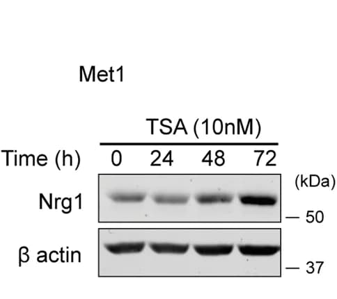 Open access visualization of Gel, Protein Levels, Nrg1, Trichostatin A, TSA