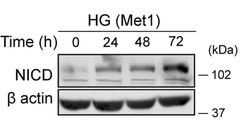 Open access visualization of Gel, Western Blot, NOTCH intracellular domain, NICD, Protein Levels