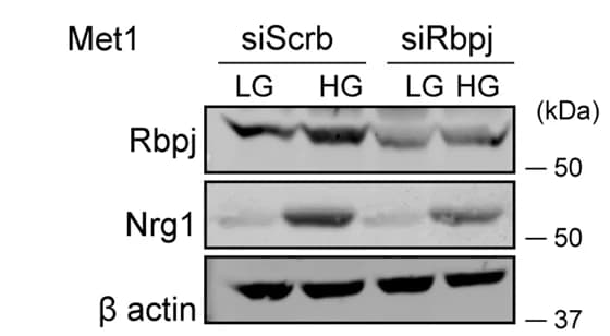 Open access visualization of Gel, NRG1, RBPJ, Protein Levels, Low Glucose