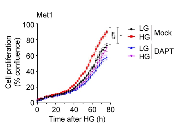 Open access visualization of Line Plot, Error Bars, Cellular Proliferation, Low Glucose, High Glucose