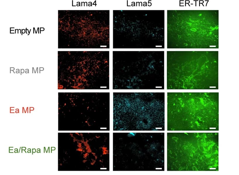 Open access visualization of Microscopy, Immunofluorescence images, Laminin 4, Laminin 5, ER-TR7