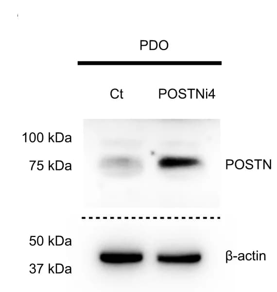 Open access visualization of Gel, POSTN Protein, PDOs, POSTNi4, Control Cells