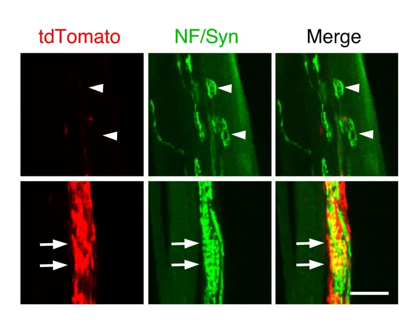Open access visualization of Microscopy, Annulospiral Endings, Neuromuscular Junctions