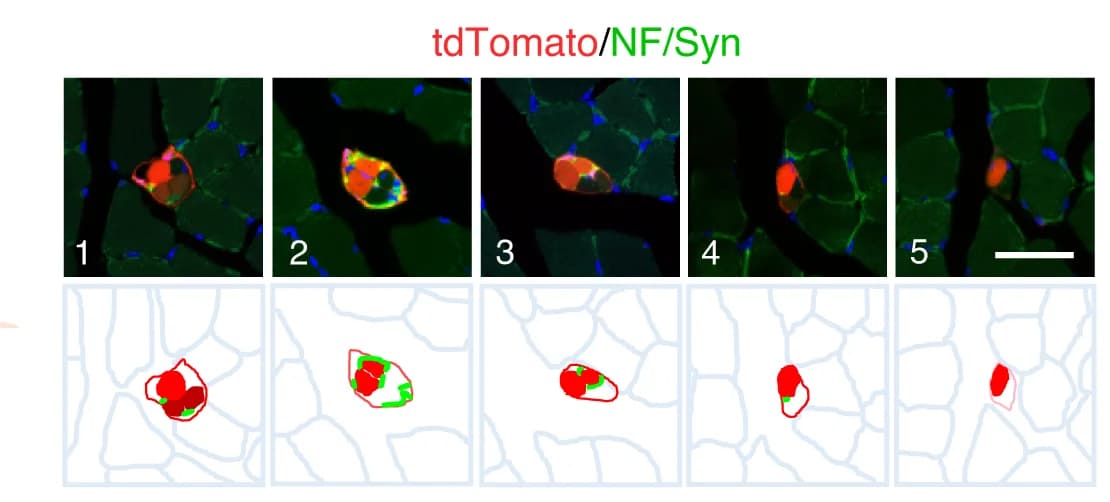 Open access visualization of Microscopy, Illustration, Tdtomato, Intrafusal Fibers, Muscle Spindle