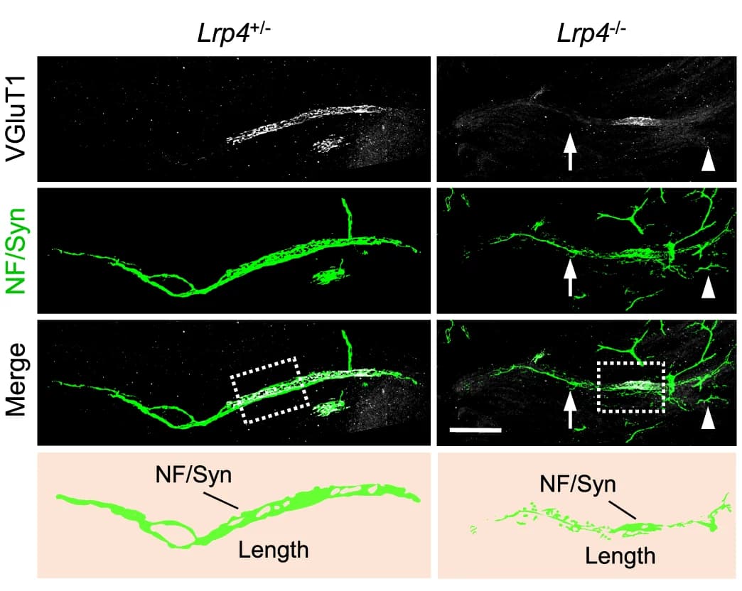Open access visualization of Microscopy, TA Muscle, VGluT1, NF/Syn, Axon Terminals