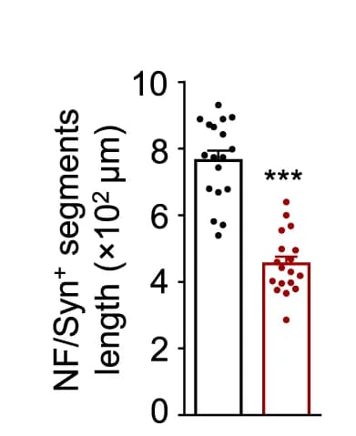 Open access visualization of Bar Plot, Error Bars, VGluT1, NF/Syn, Lrp4