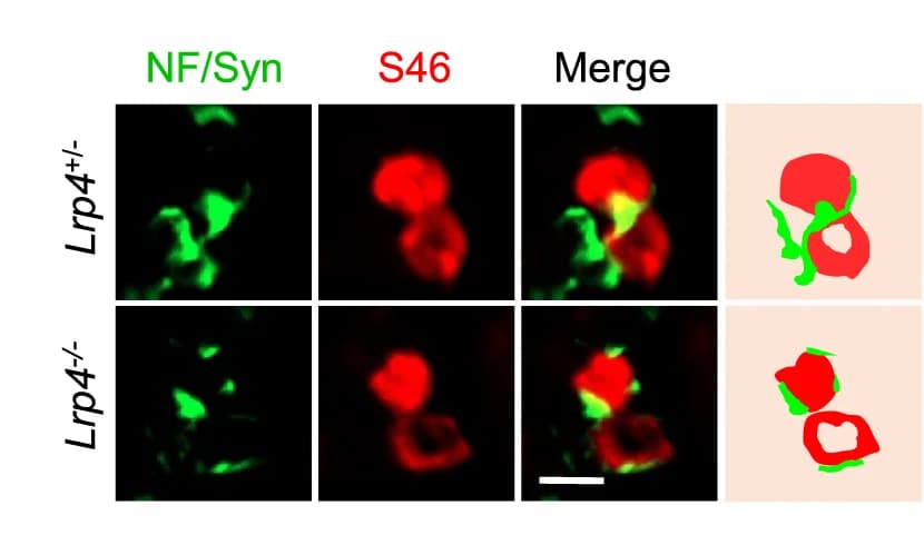 Open access visualization of Microscopy, Illustration, TA Muscle, NF/Syn, S46