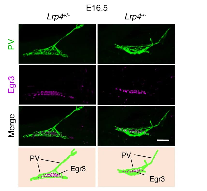 Open access visualization of Microscopy, Lrp4 mutant, Muscle spindle, Egr3 expression