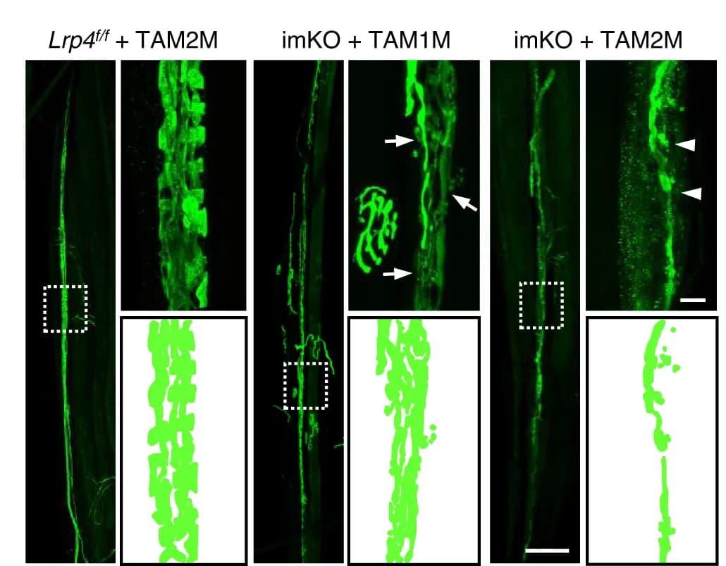 Open access visualization of Microscopy, Annulospiral endings, Tamoxifen, imKO mice, EDL muscles