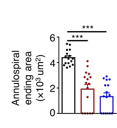 Open access visualization of Bar Plot, Error Bars, Annulospiral ending area, Muscle spindle