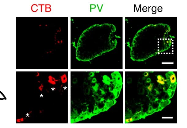 Open access visualization of Microscopy, DRG Sections, CTB, PV Antibodies, Neurons