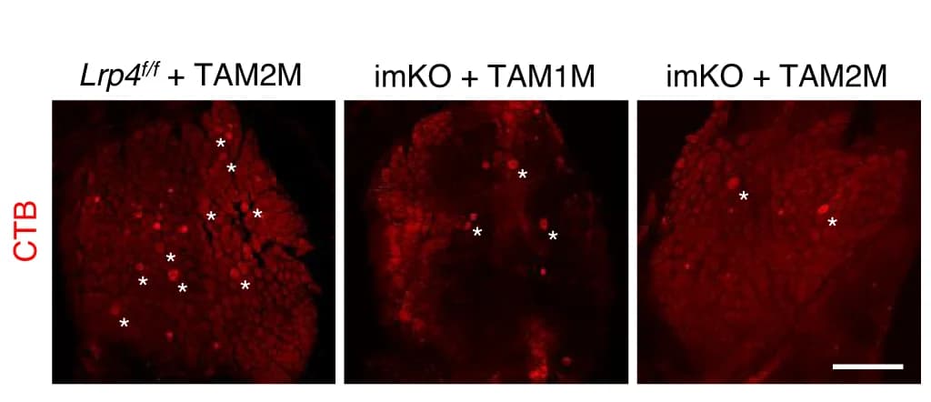 Open access visualization of Microscopy, DRG, CTB, Neurons, Soma Size
