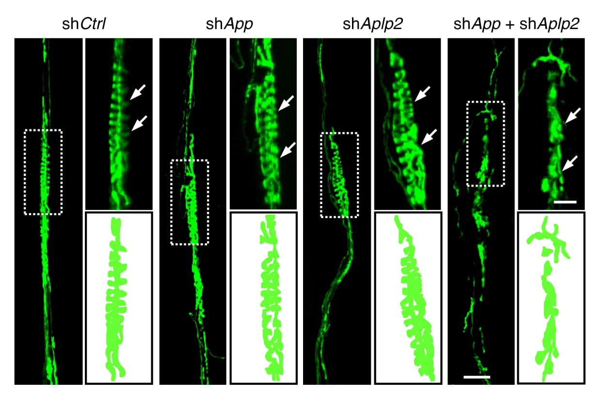 Open access visualization of Microscopy, Muscle Spindle, Immunofluorescence, Nf/Syn, Control shRNA