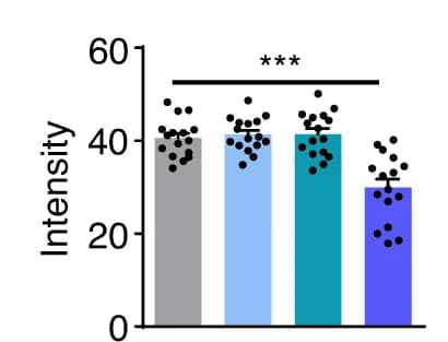 Open access visualization of Bar Plot, Error Bars, Muscle Spindle, App Silencing, Aplp2 Silencing
