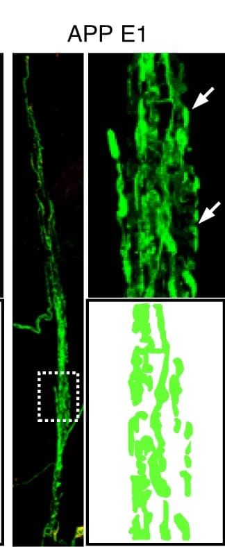 Open access visualization of Microscopy, EDL Muscles, APP E1, Recombinant Proteins, NF/Syn