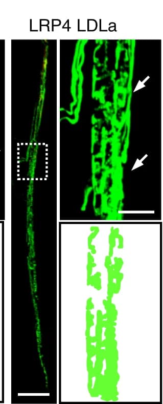 Open access visualization of Microscopy, EDL Muscles, LRP4 LDLa, Recombinant Proteins, NF/Syn
