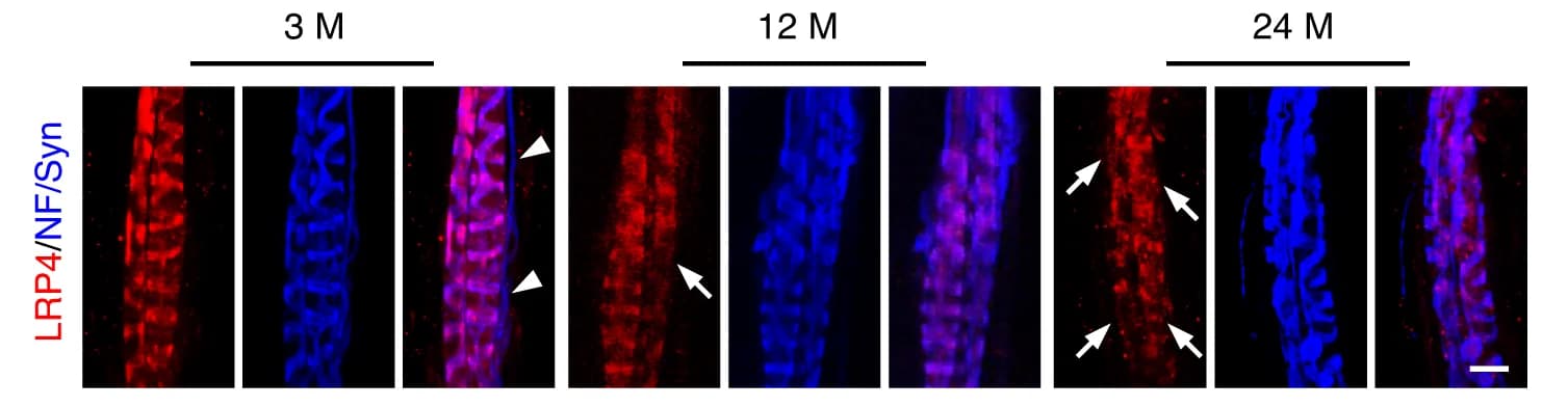 Open access visualization of Microscopy, EDL Muscles, Mice, Immunofluorescence, LRP4