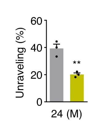 Open access visualization of Bar Plot, Error Bars, Muscle Spindles, Mice, Quantification