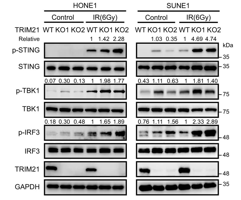 Open access visualization of Gel, Western Blot, STING, TBK1, IRF3