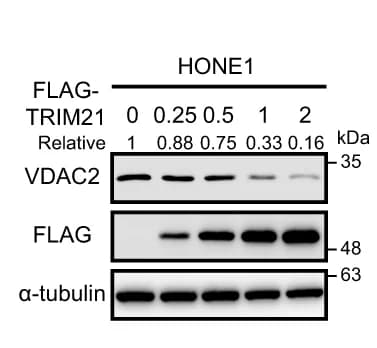 Open access visualization of Gel, VDAC2, HONE1 Cells, FLAG-tagged TRIM21