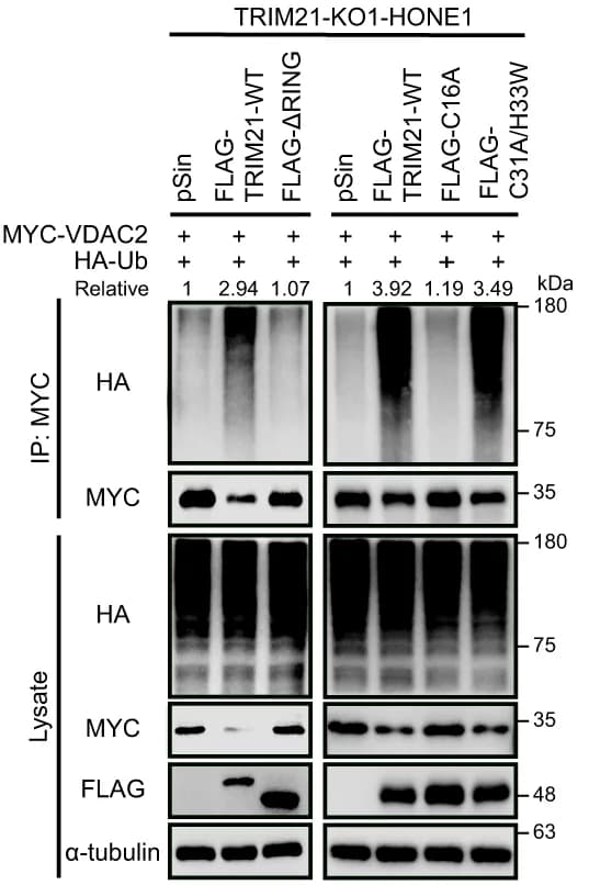 Open access visualization of Gel, Ubiquitination, MYC-tagged VDAC2, TRIM21-KO, HONE1 Cells