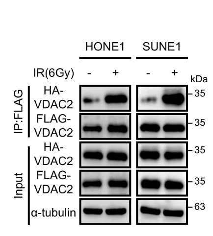 Open access visualization of Gel, Co-IP, FLAG Antibody, VDAC2, NPC Cells