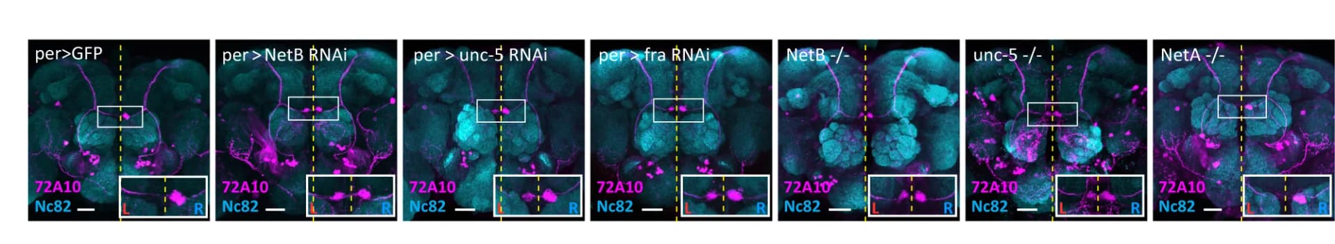 Open access visualization of Microscopy, Confocal Images, Adult Brains, Phenotype, netB