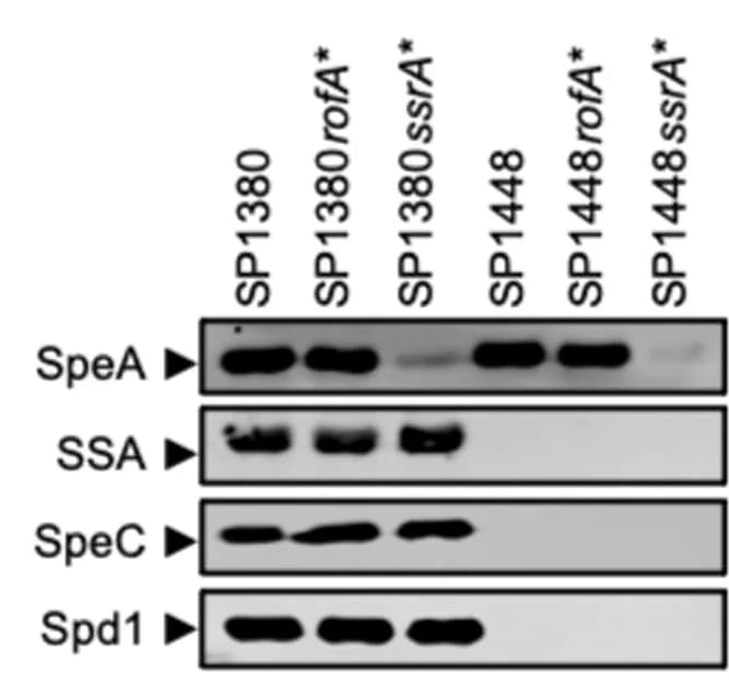 Open access visualization of Gel, Western Immunoblot, Superantigens, DNase, Culture Supernatants