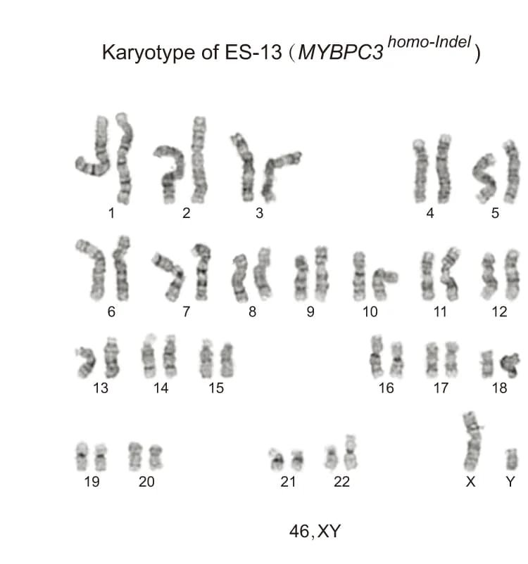 Open access visualization of Microscopy, G-banding Analysis, ESC Lines, MYBPC3, Homo-Indel Genotype