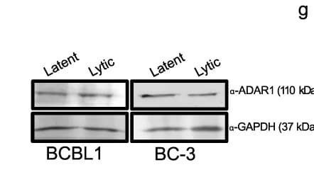Open access visualization of Gel, Western Blot Analysis, Proteins, BCBL1 Cells, BC-3 Cells
