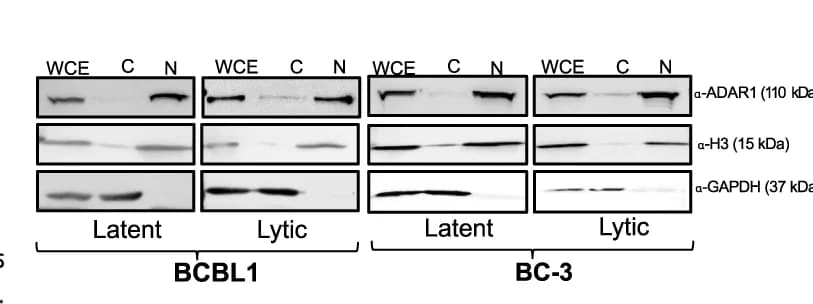 Open access visualization of Gel, Western Blot Analysis, Proteins, Subcellular Fractionation, Whole Cell Extract